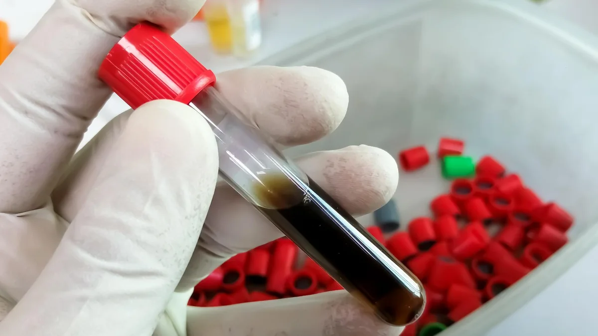 Gloved laboratory hand holding a labeled blood-research sample vial.