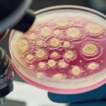 Petri-dish culture sample being examined beside a laboratory microscope.