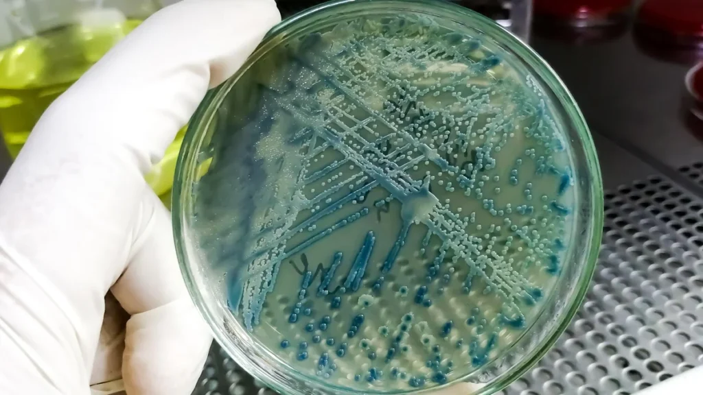 Close-up of a bacterial culture plate held in a microbiology laboratory.