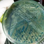 Close-up of a bacterial culture plate held in a microbiology laboratory.