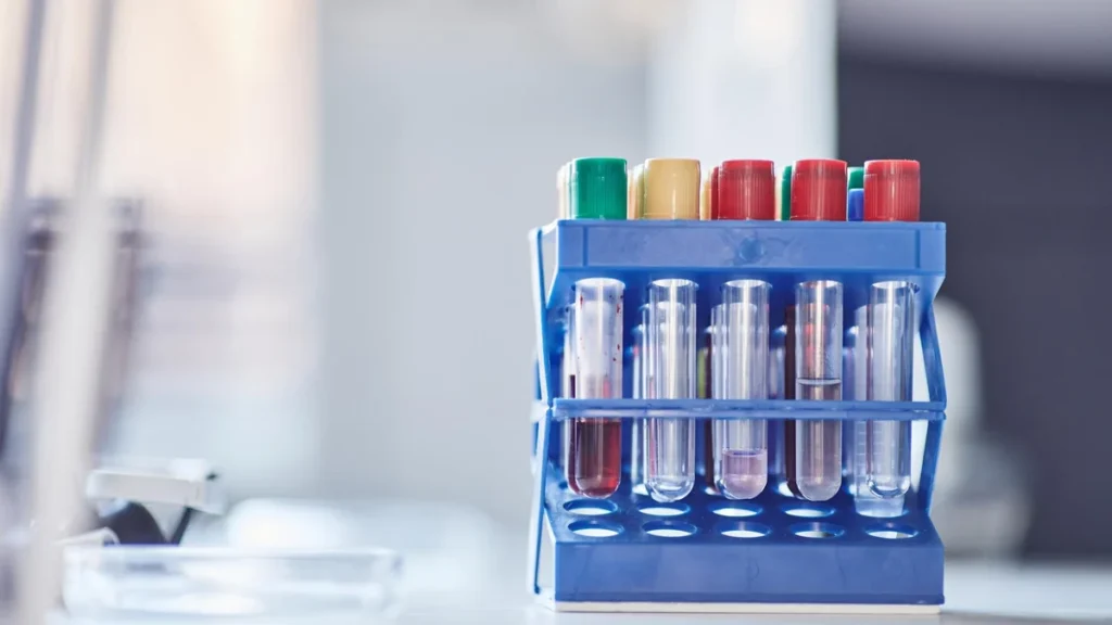 Laboratory test tubes arranged in a rack for controlled research work.