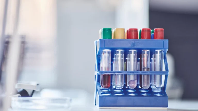 Laboratory test tubes arranged in a rack for controlled research work.